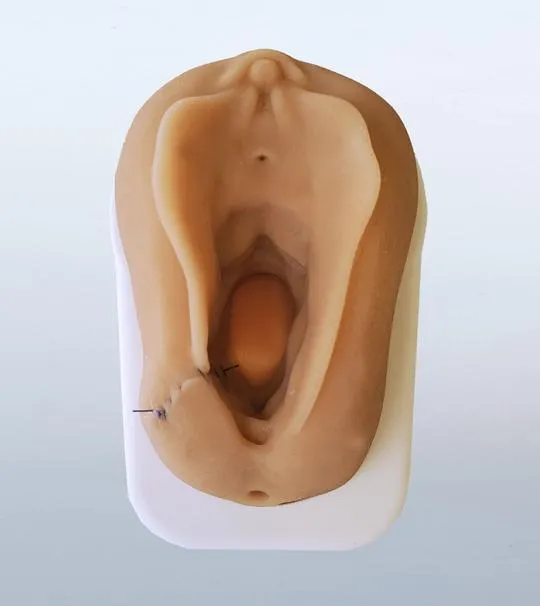 Perineum Injury Suturing Model